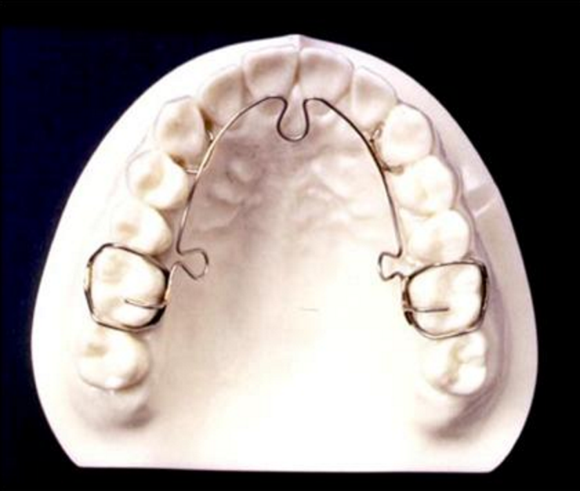 BURKE FAMILY DENTISTRY | 579 Grand Ave E, Chatham, ON N7L 3Z2, Canada | Phone: (519) 352-5171