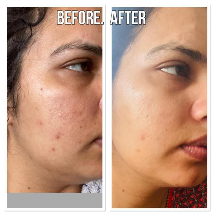Herbalife Skin Manjinder | 8642 147a St, Surrey, BC V3S 6R6, Canada | Phone: (778) 668-8034