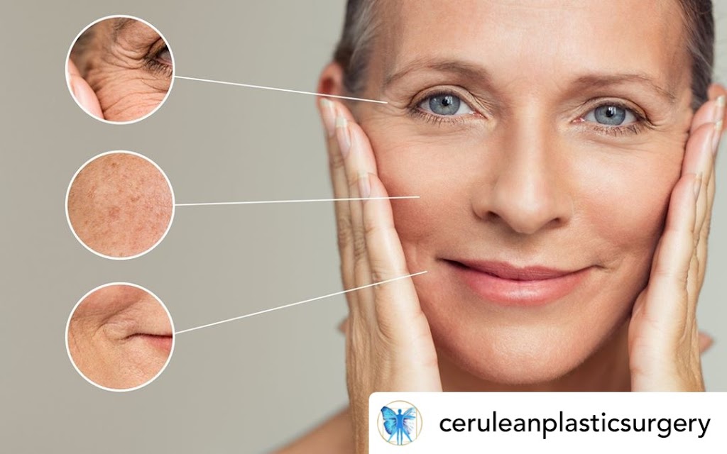 Cerulean Plastic Surgery Centre | 11012 Macleod Trail SE Suite 385, Calgary, AB T2J 6A5, Canada | Phone: (403) 225-2141