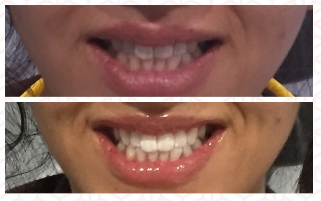Tooth Care Centre | 6061 York Regional Rd 7, Markham, ON L3P 3B2, Canada | Phone: (905) 554-3555