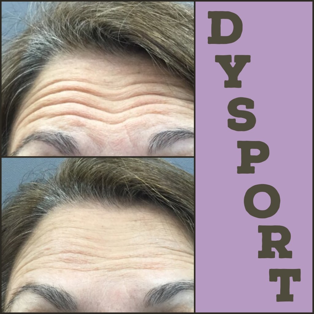 Med Cosmetics Clinic | 7700 Bathurst St #200, Thornhill, ON L4J 7Y3, Canada | Phone: (905) 597-5111