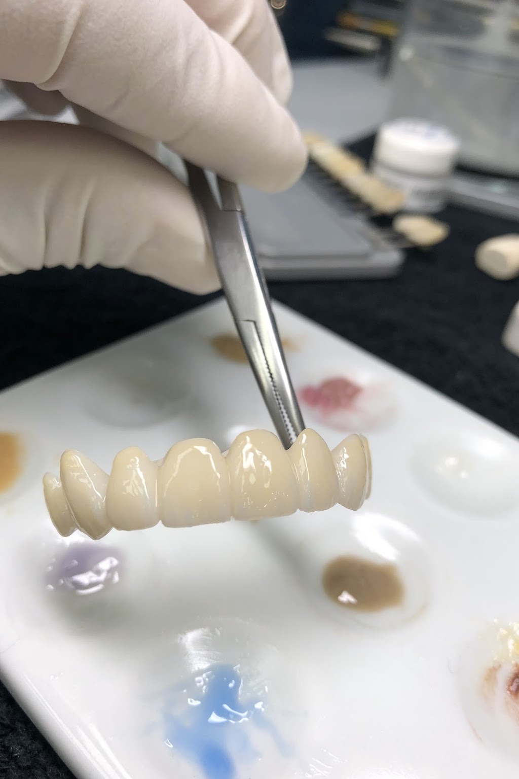 Proceram Dental Arts | 203-34654 Delair Rd, Abbotsford, BC V2S 2C9, Canada | Phone: (604) 853-7793