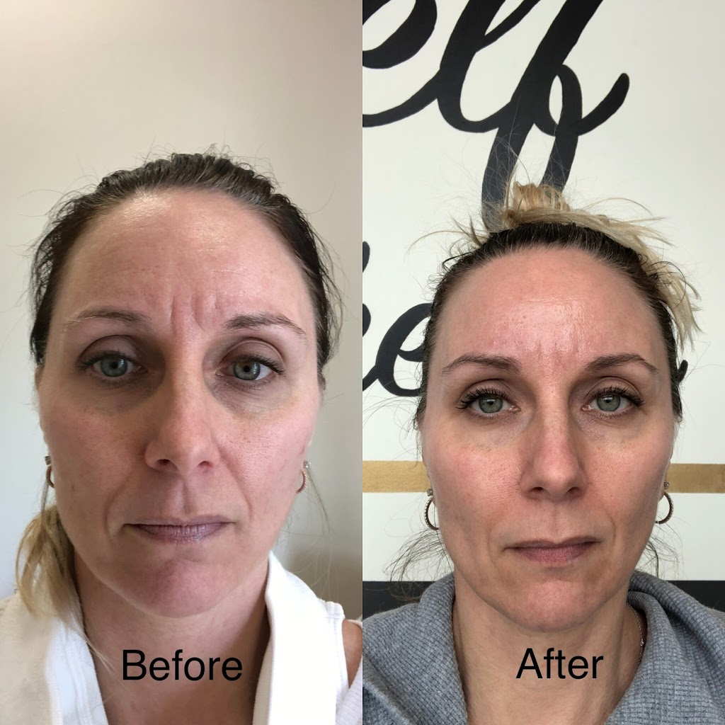 Self Aesthetics Laser and Skin Centre | 2-455 Sterling Lyon Pkwy, Winnipeg, MB R3P 2S8, Canada | Phone: (204) 237-1388