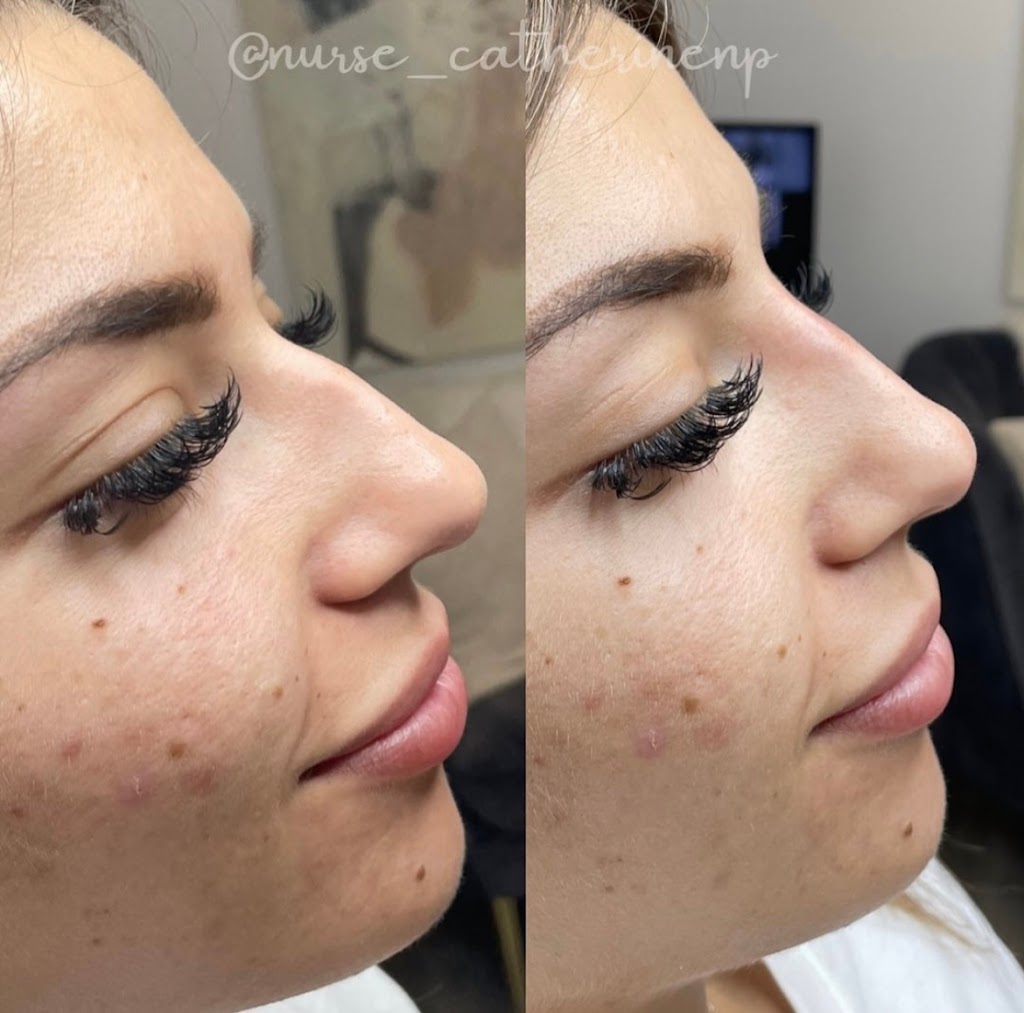 Monarchy Medispa Halifax | 480 Parkland Dr, Halifax, NS B3S 1P9, Canada | Phone: (902) 457-0525