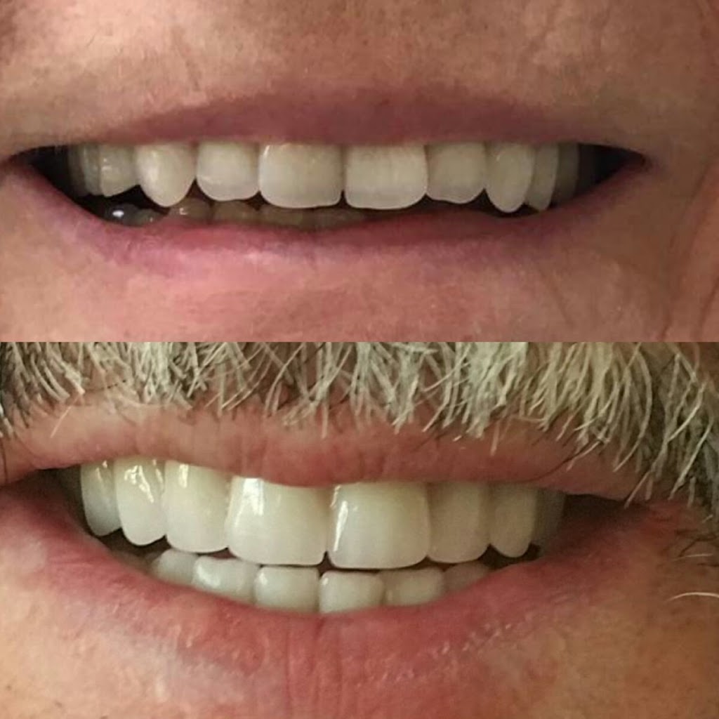Denturologiste Blainville | Prothèses dentaires Mon Sourire | 391 Boulevard Curé-Labelle, Blainville, QC J7C 2G9, Canada | Phone: (514) 506-4983
