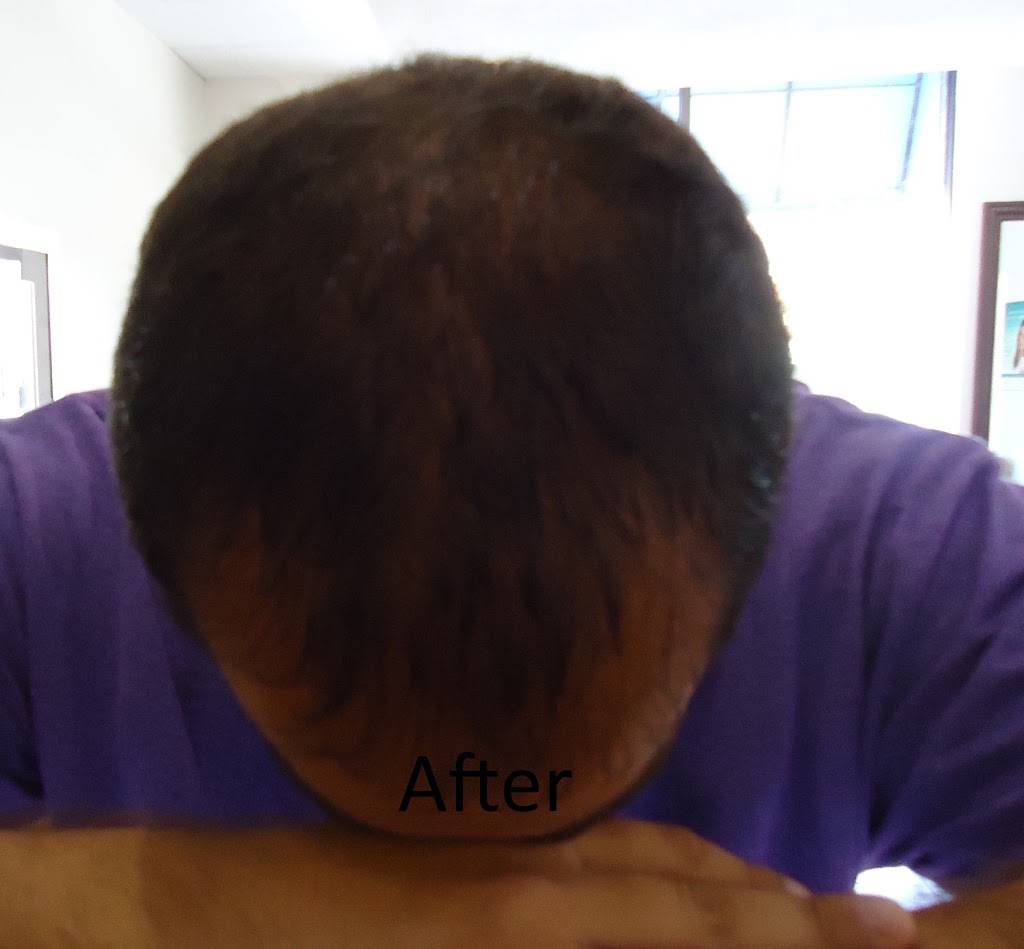 LightTouch Med Spa Oakville | 90 Reynolds St, Oakville, ON L6J 3K2, Canada | Phone: (905) 844-3400