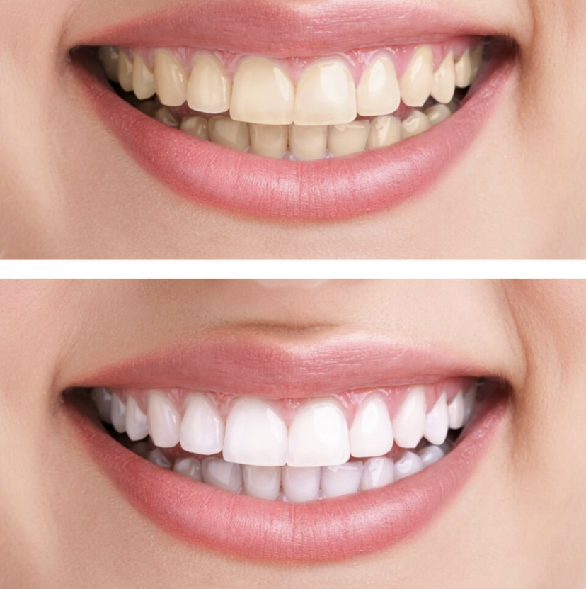 Hygiéniste dentaire mobile, Isabelle Simard, HD | 3 Rue des Oursons, Sainte-Marguerite-du-Lac-Masson, QC J0T 1L0, Canada | Phone: (450) 822-2069