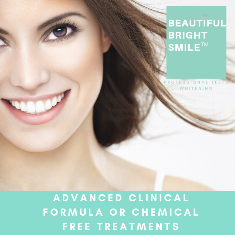 Beautiful Bright Smile | 2468 Whatcom Rd, Abbotsford, BC V3G 1E1, Canada | Phone: (604) 607-3599