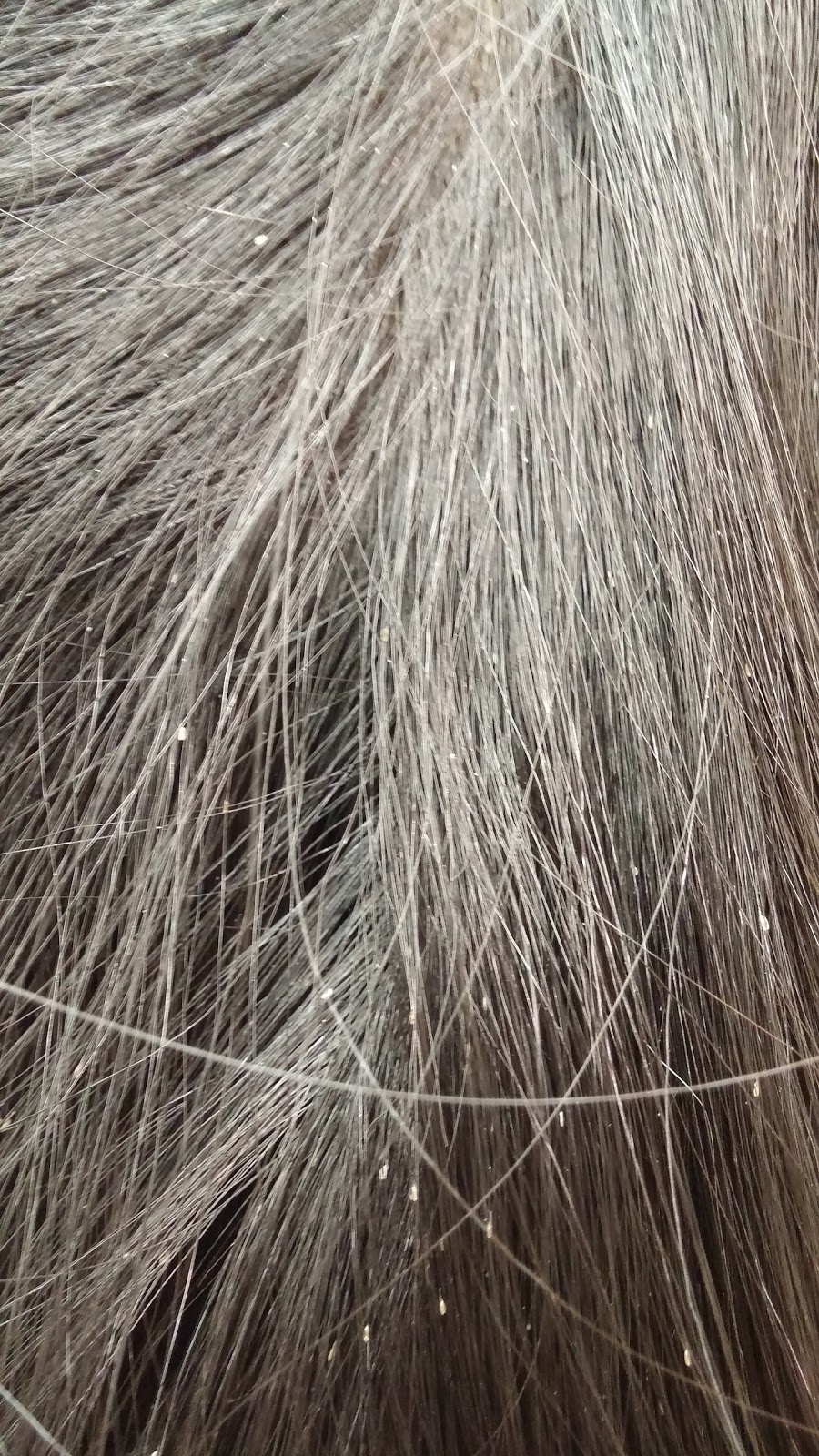 The Lice Shack | 1201 Britannia Road West Unit 7-I, Mississauga, ON L5V 1N2, Canada | Phone: (905) 997-5423