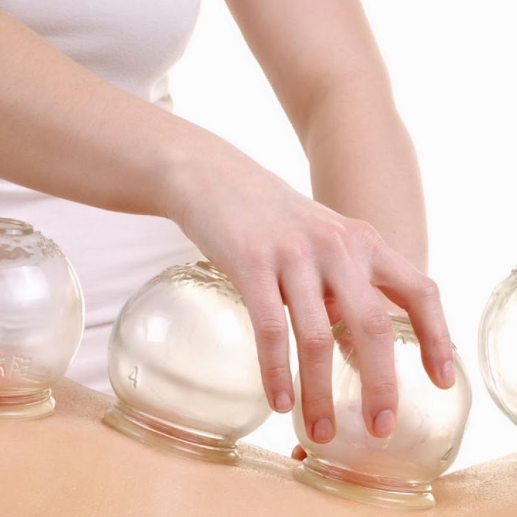 WellnessRising Acupuncture Massage Clinic | 107-8708 155 St NW, Edmonton, AB T5R 1W2, Canada | Phone: (780) 667-7780