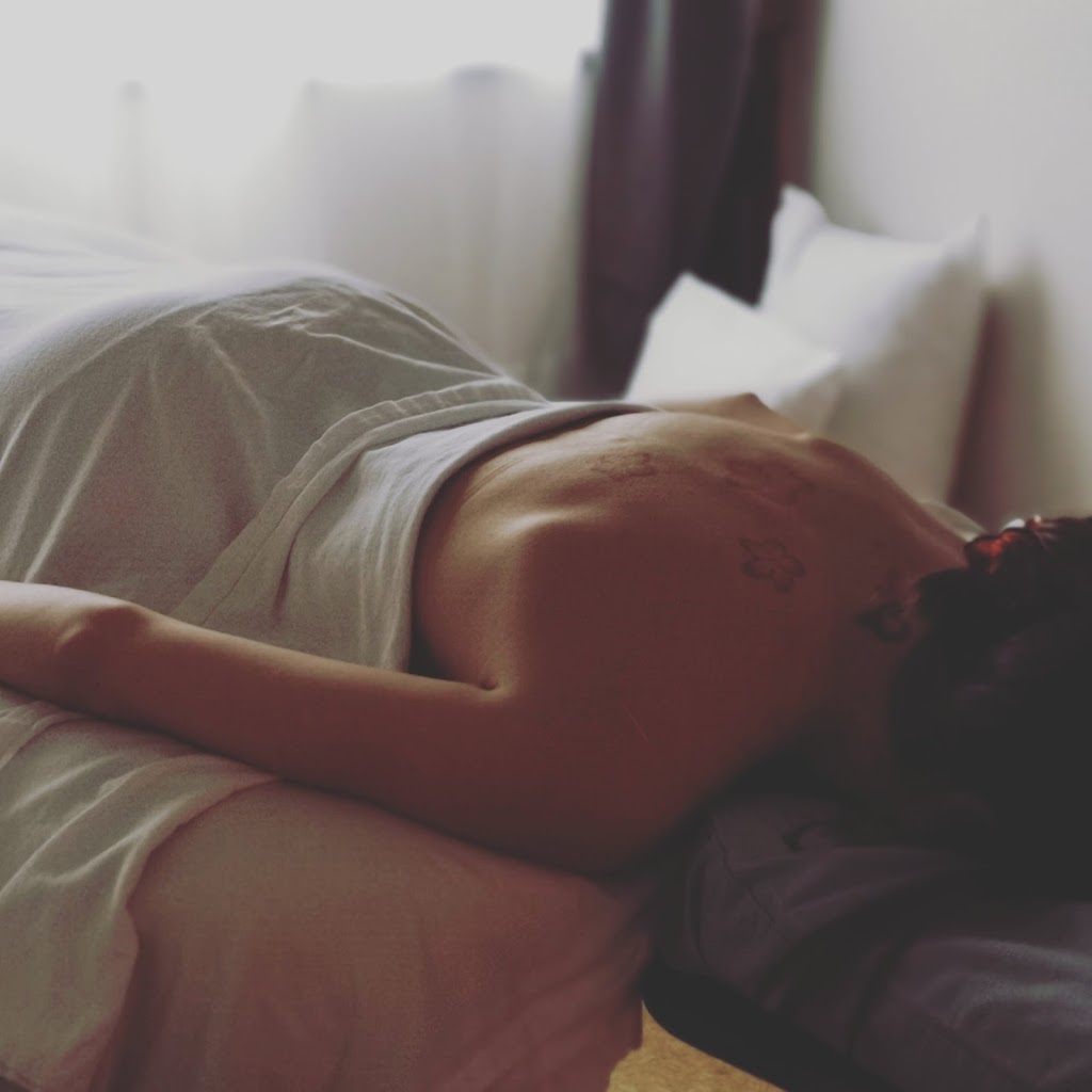 Morgan Rigney, Acupuncture & Cupping Therapy | Tillicum Area | 101-3645 Tillicum Rd, Victoria, BC V8W 4H4, Canada | Phone: (236) 882-3441