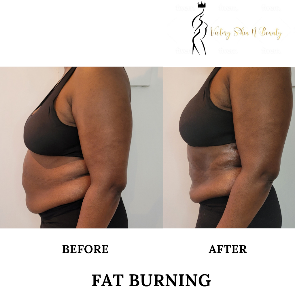 VSNB ESTHÉTIQUE | 87 Blvd Saint-Elzéar O, Laval, QC H7M 1E7, Canada | Phone: (438) 887-3773