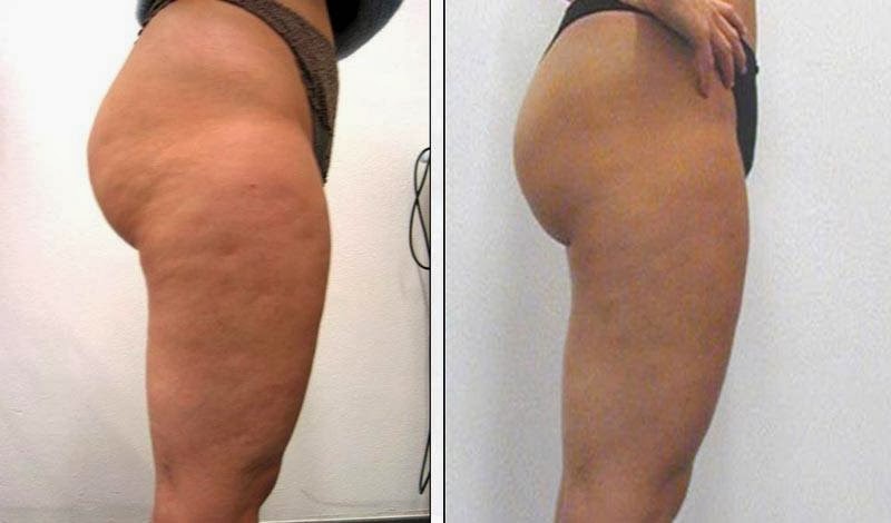 Natural AntiAgeing Clinic | 2601 Matheson Blvd E #15, Mississauga, ON L4W 5A8, Canada | Phone: (905) 629-8088