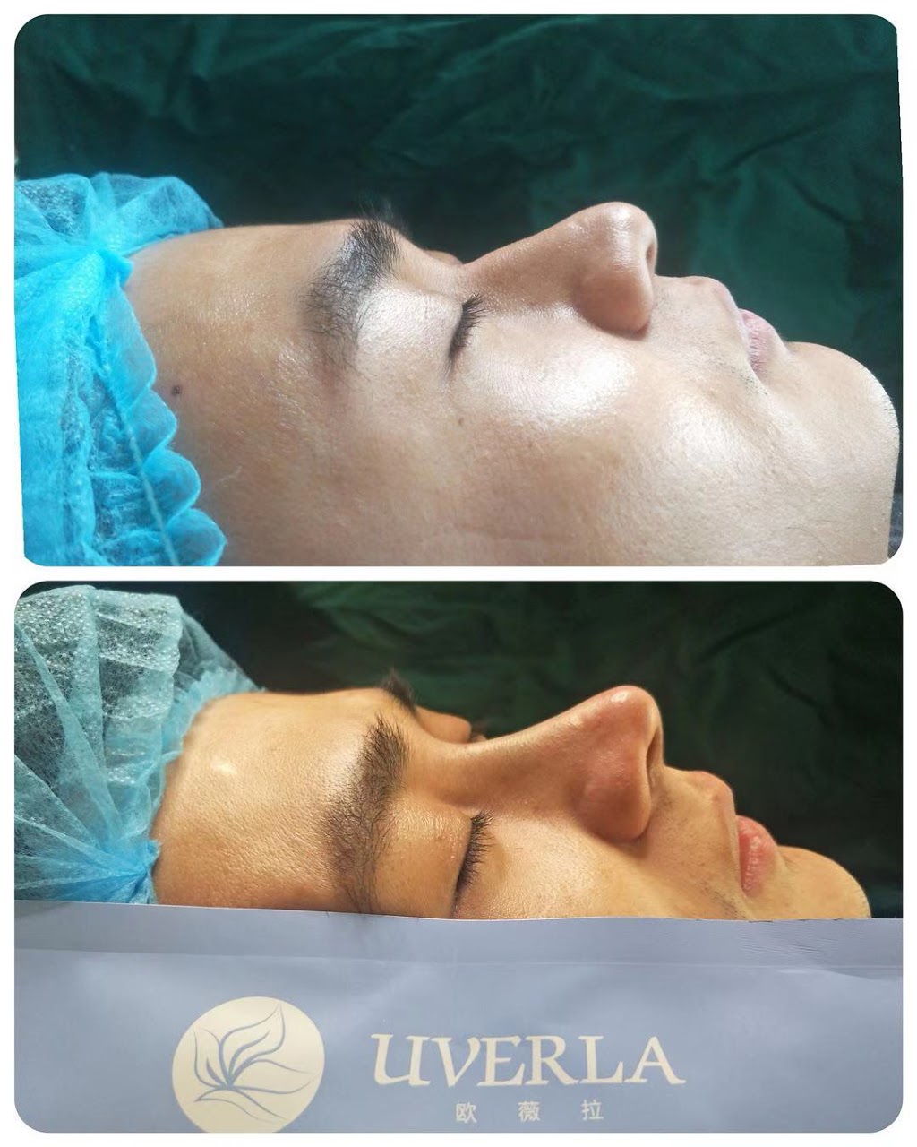 Oakville Flawless Cosmetic | 3075 Hospital Gate #109 First Floor Of North Oakville Medical Center, Oakville, ON L6M 1M1, Canada | Phone: (289) 885-5660