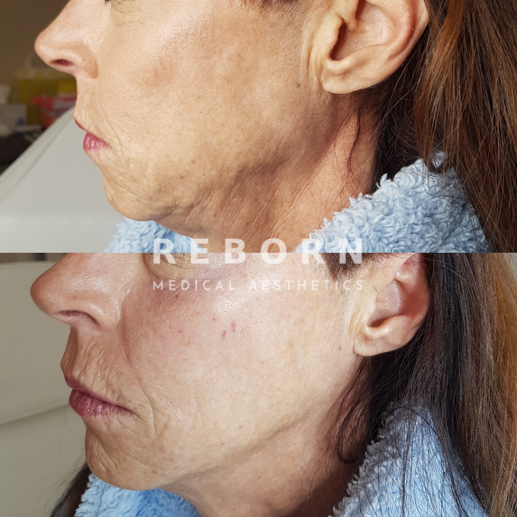 Reborn Medical Aesthetics | 1850 Prairies Ave, Orléans, ON K1E 2R4, Canada | Phone: (613) 581-9880