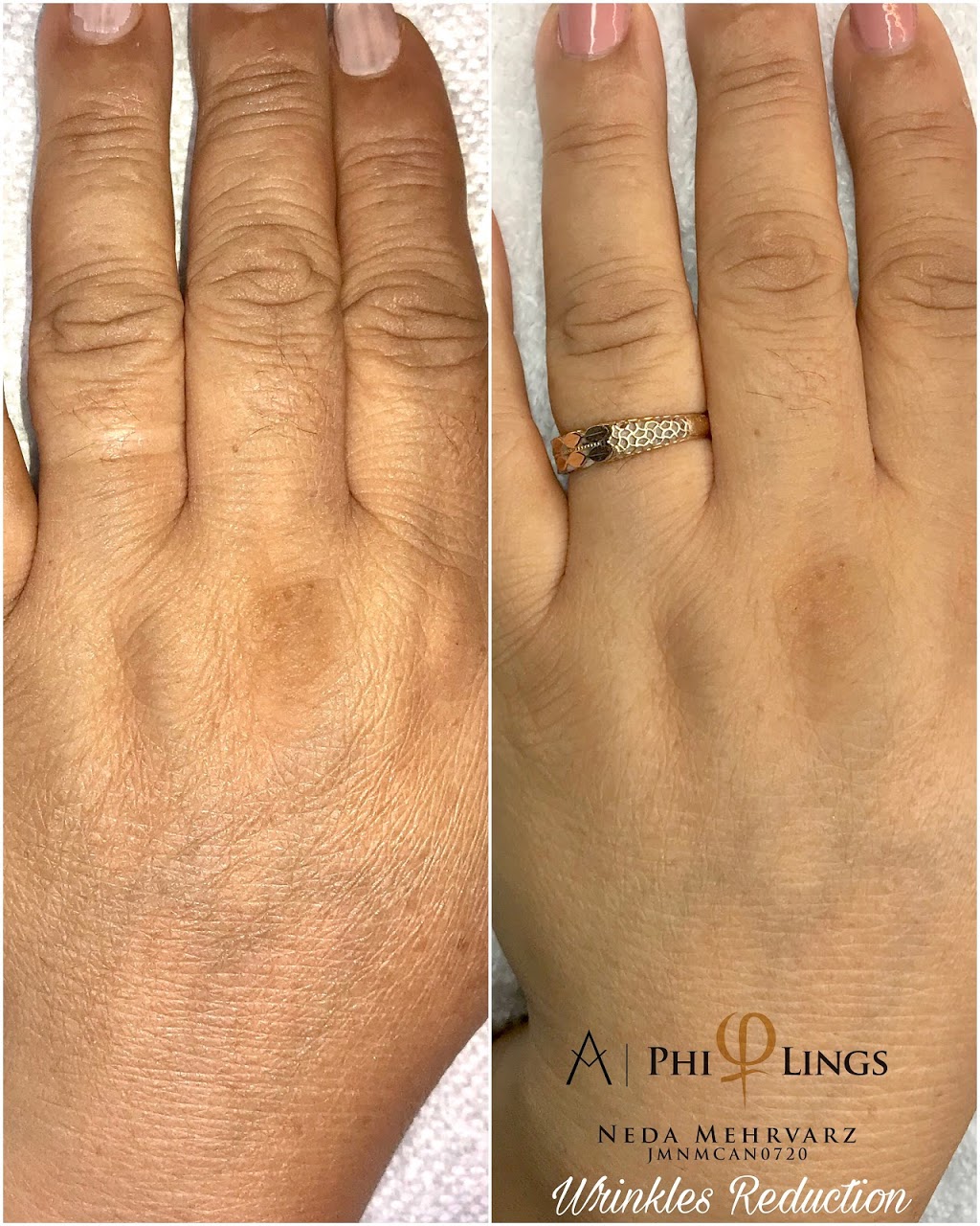 Canada Microblading - Thunder Bay | 2817 Arthur St E, Thunder Bay, ON P7E 5E5, Canada | Phone: (807) 355-3040