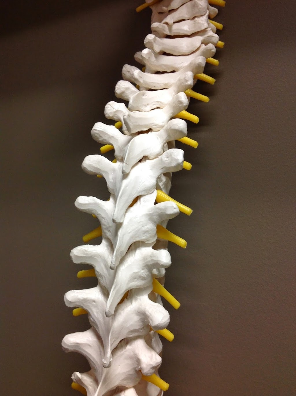 Beyond Wellness Chiropractic | 10990 Chinguacousy Rd #2, Brampton, ON L7A 0P1, Canada | Phone: (905) 970-9355
