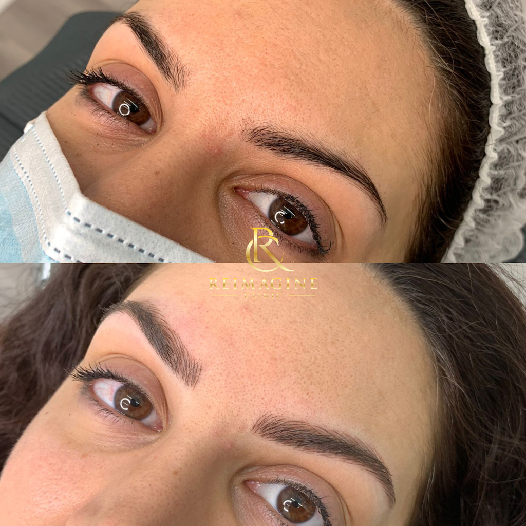 Reimagine Clinic | Montreal | 9359 Rue Lajeunesse, Montréal, QC H2M 1S5, Canada | Phone: (438) 686-8460
