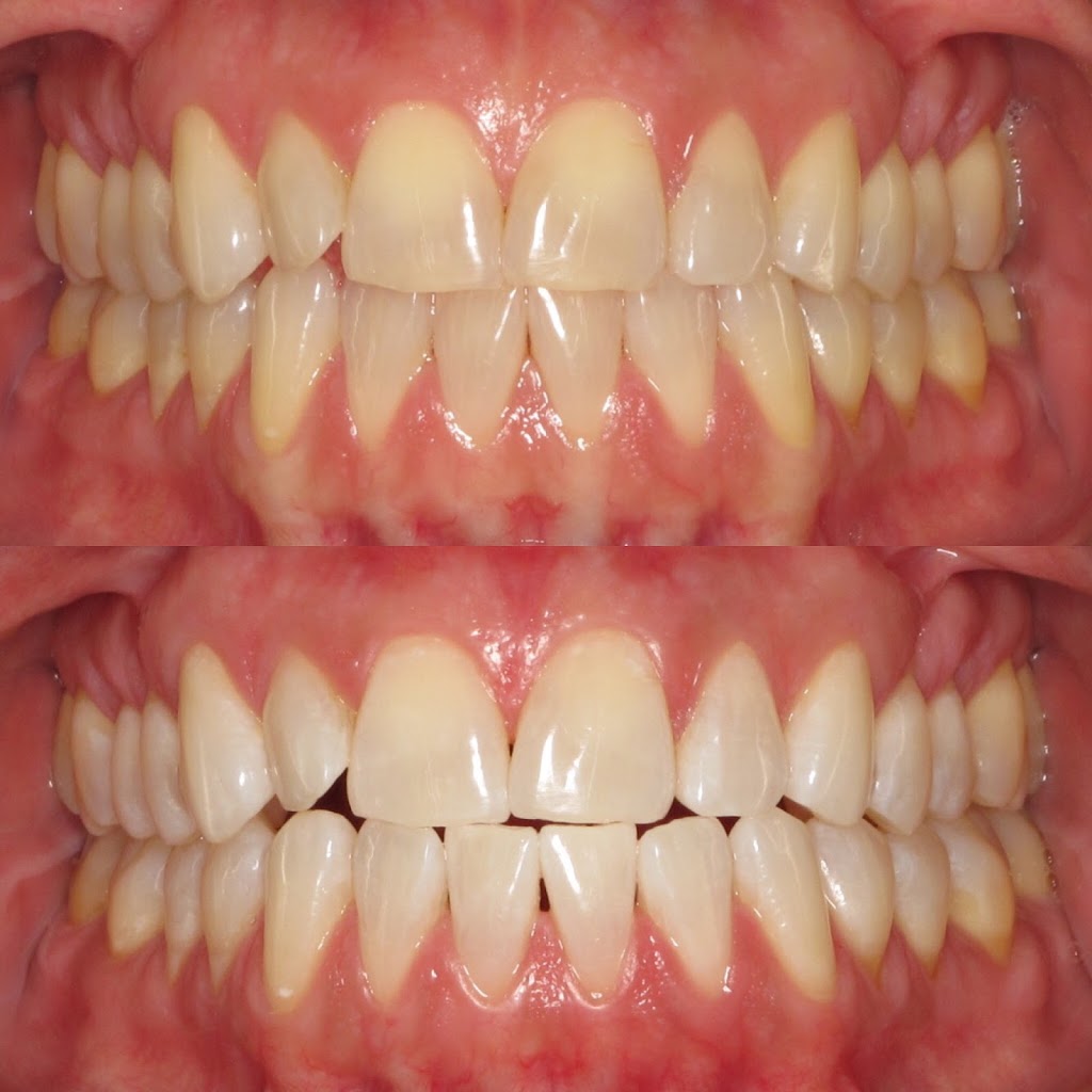 Woodbridge Vaughan Dental | 1160 Clarence St #4, Woodbridge, ON L4H 2V3, Canada | Phone: (905) 850-3443