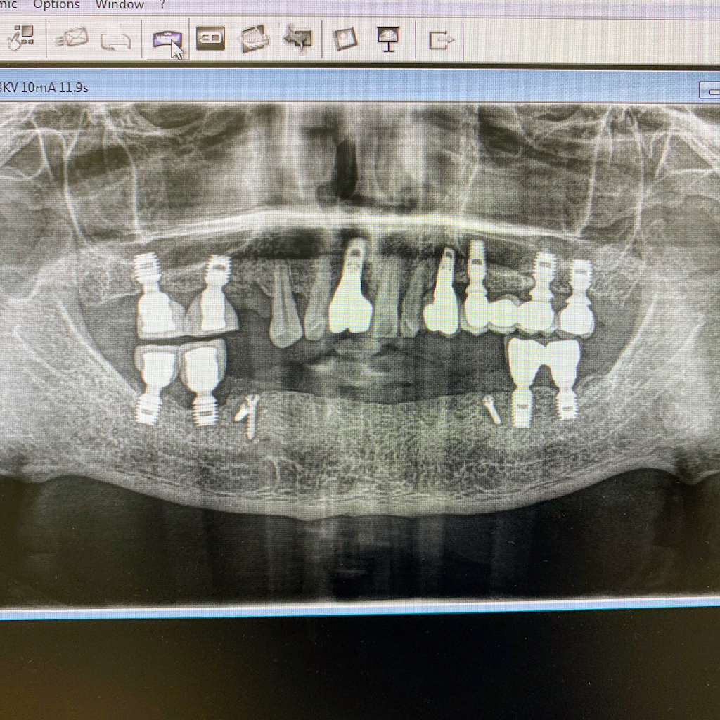Bellwether Dental Implants & Oral Surgery | 12 Bellwether Way Ste 114, Bellingham, WA 98225, USA | Phone: (360) 366-8026