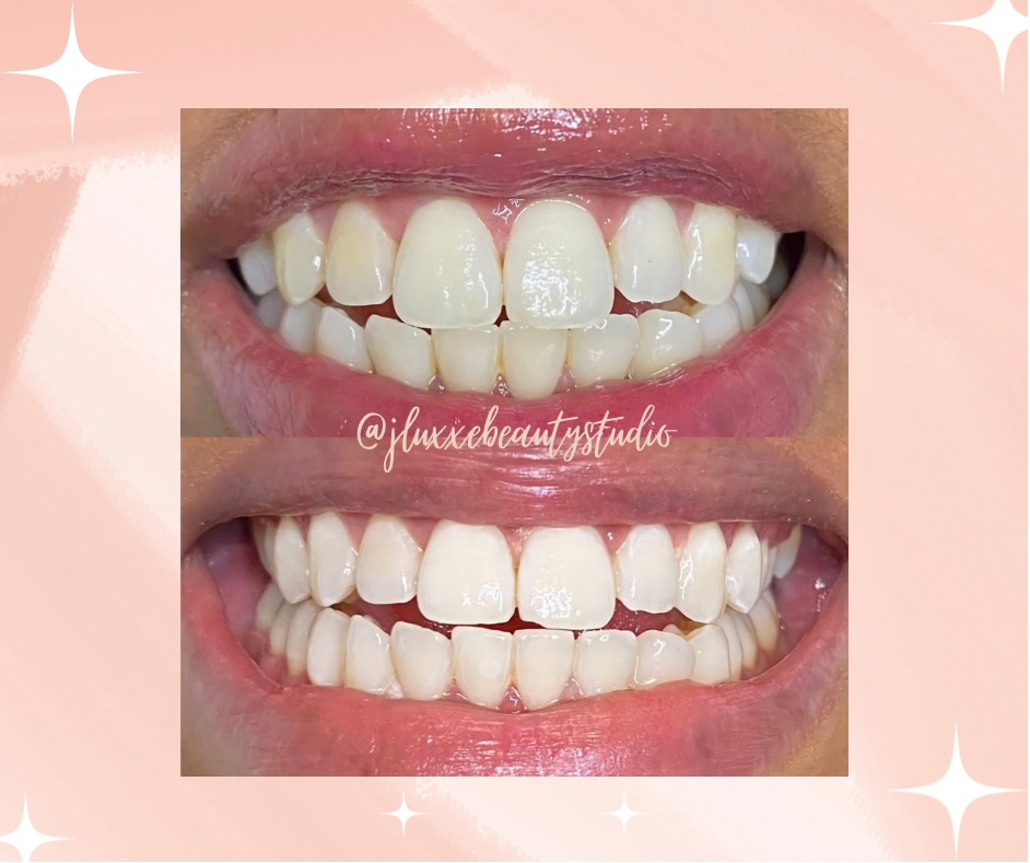 JLuxxe Beauty Studio | McKay Ave, Burnaby, BC V5J 3R9, Canada | Phone: (236) 512-6348