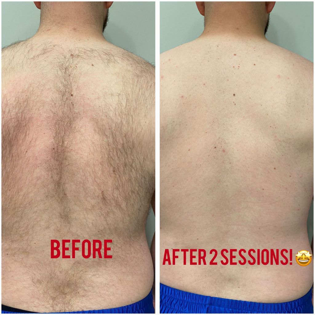 Royal Skincare Clinic | 19991 96 Ave, Langley, BC V1M 3C6, Canada | Phone: (778) 298-7546