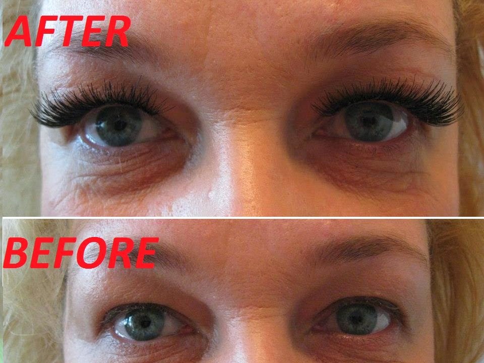 Toronto Beauty Clinic | 551 Wilson Heights Blvd, North York, ON M3H 2V7, Canada | Phone: (416) 398-0111