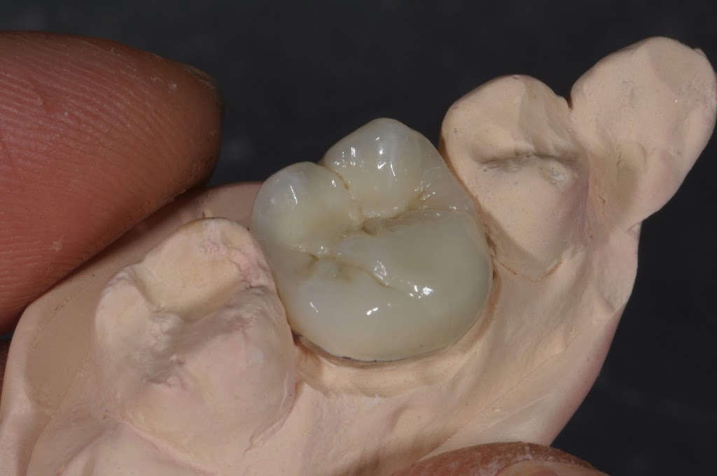 Chois Dental Studio | 1270 King St E, Cambridge, ON N3H 3P8, Canada | Phone: (289) 788-3996