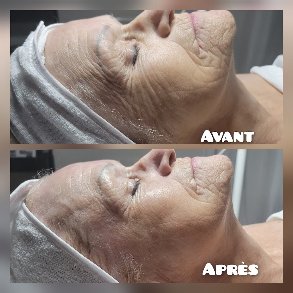 NaturEsthétique | 1128 Rue Ferland, Saint-Félicien, QC G8K 1H9, Canada | Phone: (418) 613-0711