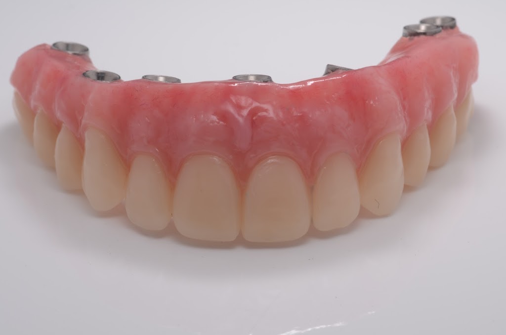 Dr Philippe Girard Prosthodontiste | 1145 Boulevard Lebourgneuf #100, Québec, QC G2K 2K8, Canada | Phone: (418) 624-7333