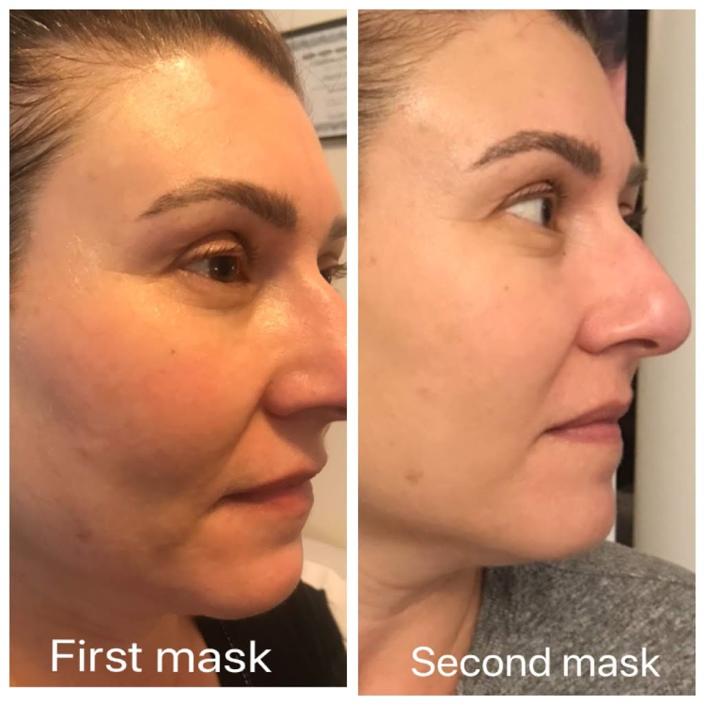 Noor Aesthetics | 2004 Kurelo Dr, Oshawa, ON L1G 8L7, Canada | Phone: (647) 299-1486