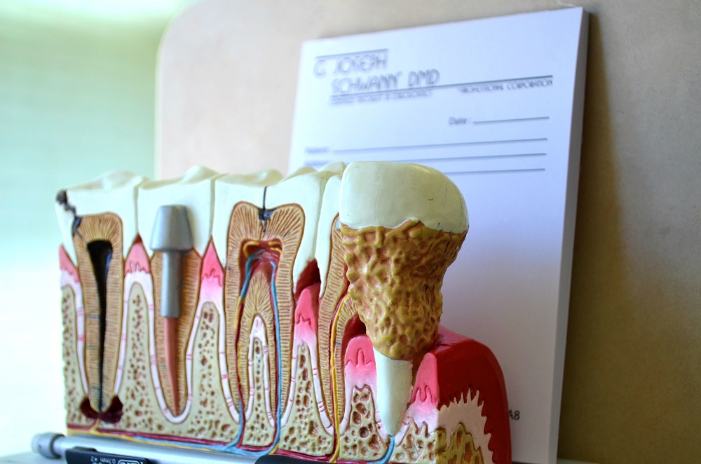 Foothills Endodontics - Dr. Joseph Schwann & Dr. Sukhman Chahal | 1600 90 Ave SW #158c, Calgary, AB T2V 5A8, Canada | Phone: (403) 278-6000
