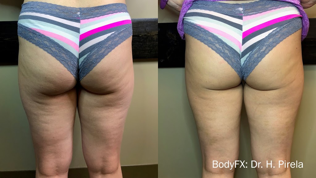 Elan Laser Aesthetics | 2258 Belmont Ct, Burlington, ON L7P 3N3, Canada | Phone: (905) 220-2258