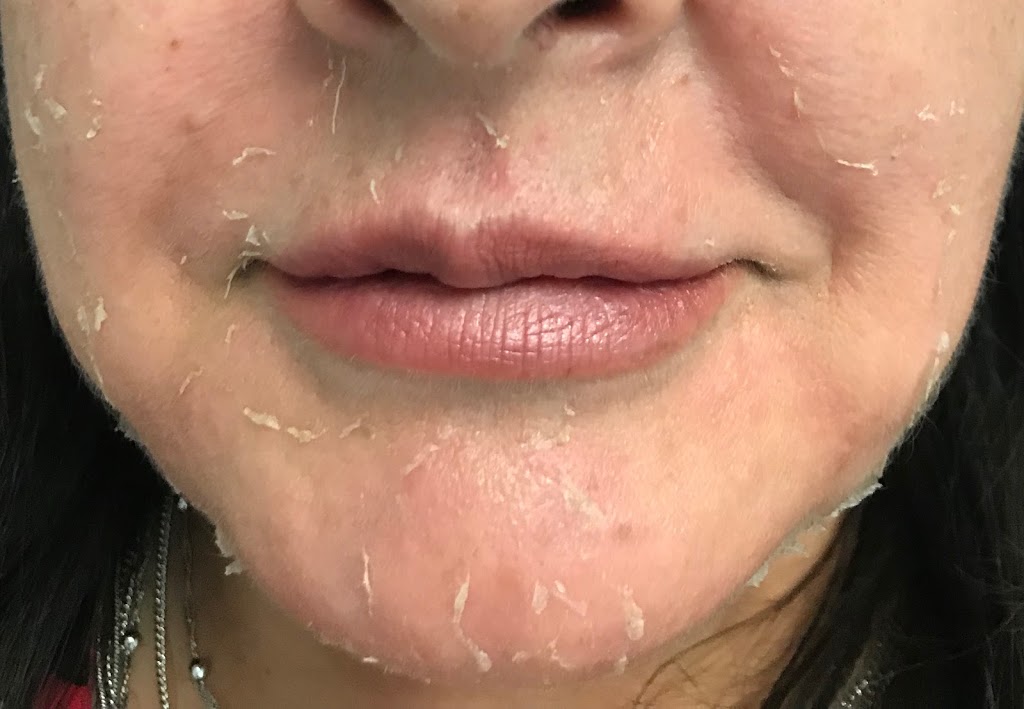 Skin Medic Ltd | 5875 Hwy 7 unit 15A, Woodbridge, ON L4L 1T9, Canada | Phone: (905) 850-8025