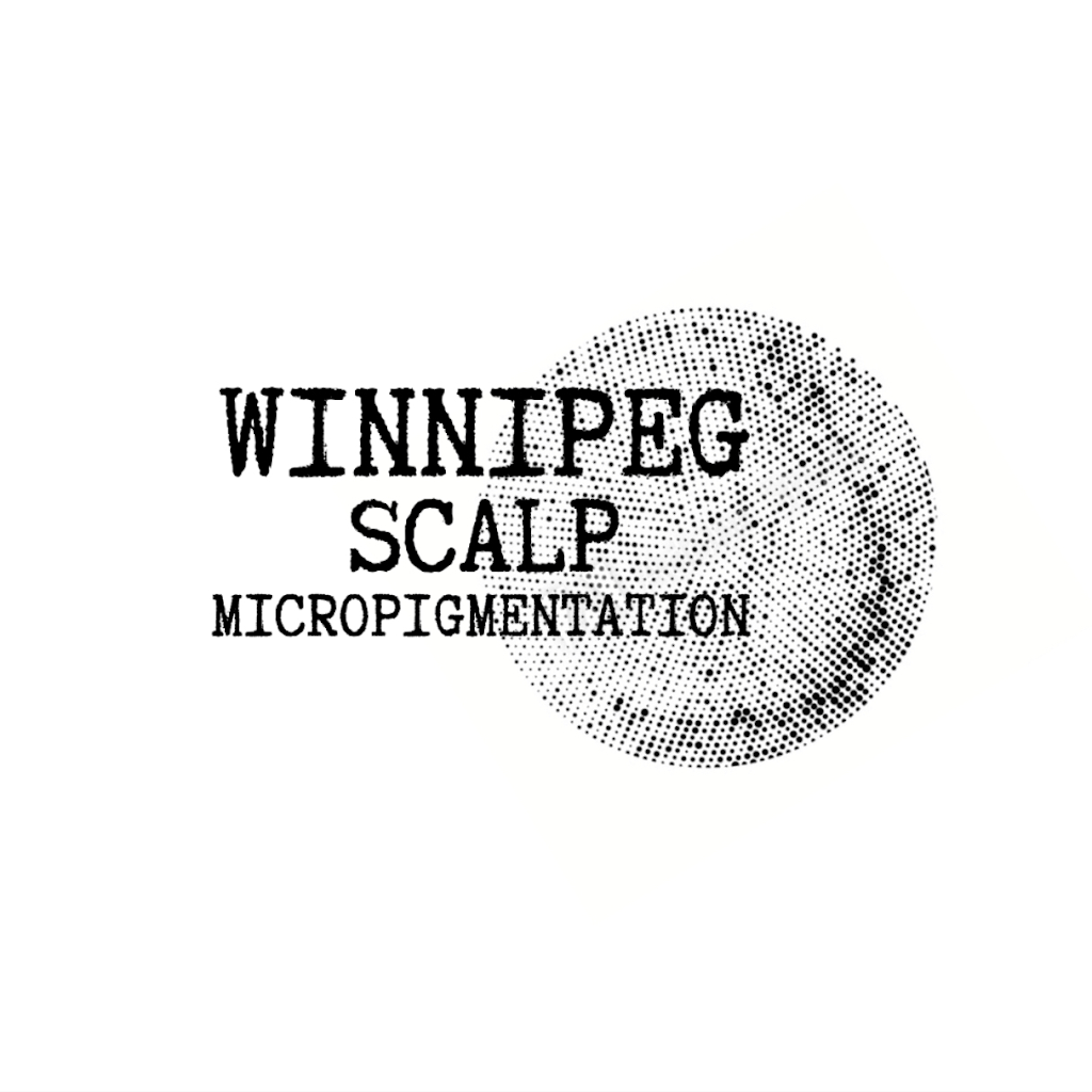 Winnipeg Scalp Micropigmentation | 3 Torrington Rd, Winnipeg, MB R3Y 1B4, Canada | Phone: (204) 999-0229