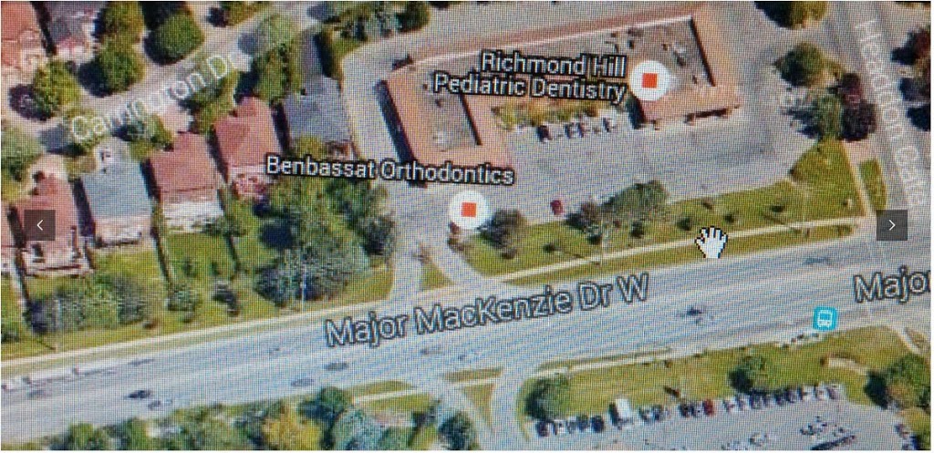 Benbassat Orthodontics | 10 Headdon Gate unit 1a, Richmond Hill, ON L4C 8A2, Canada | Phone: (905) 224-7916