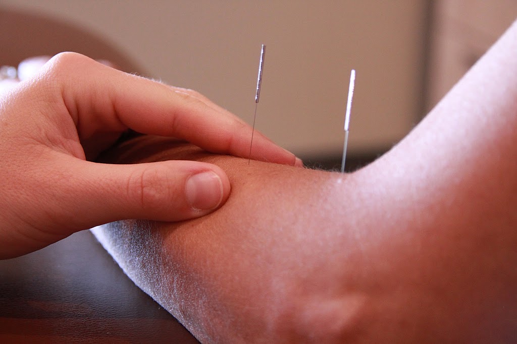 Skill Builders Physiotherapy & Rehabilitation Centre | 370 Bayview Dr #100, Barrie, ON L4N 7L3, Canada | Phone: (705) 727-0319
