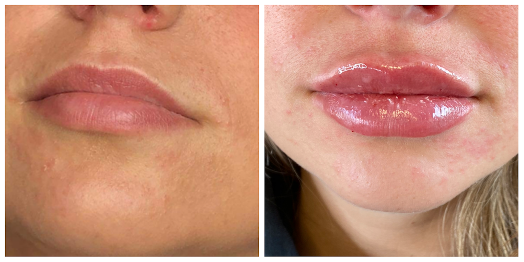 Clinique my face | 5551 Bd Laurier Suite 202, Terrebonne, QC J7M 1T7, Canada | Phone: (514) 980-6228