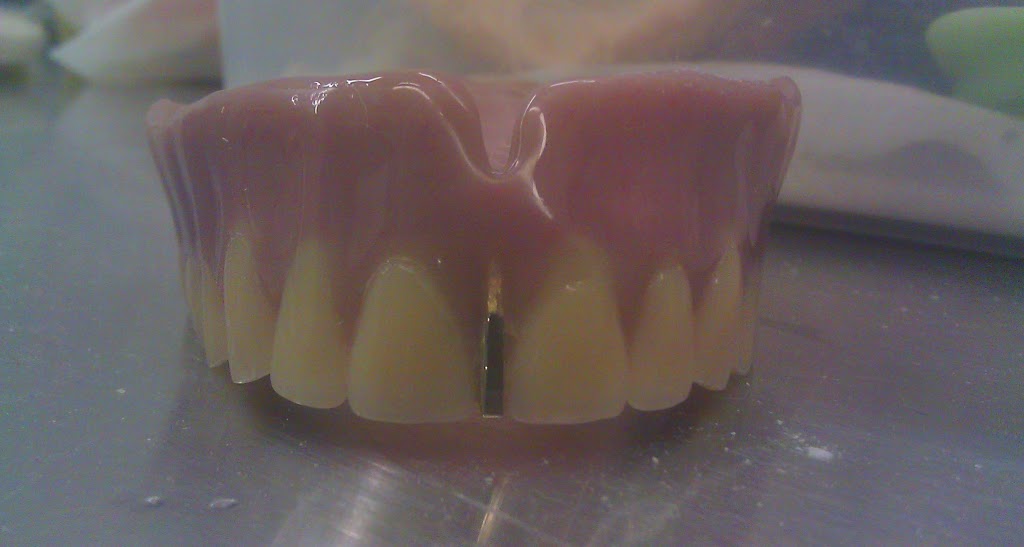 Lima Denture and Implant Solutions | 797 Richmond Rd, Ottawa, ON K2A 0G7, Canada | Phone: (613) 728-5532
