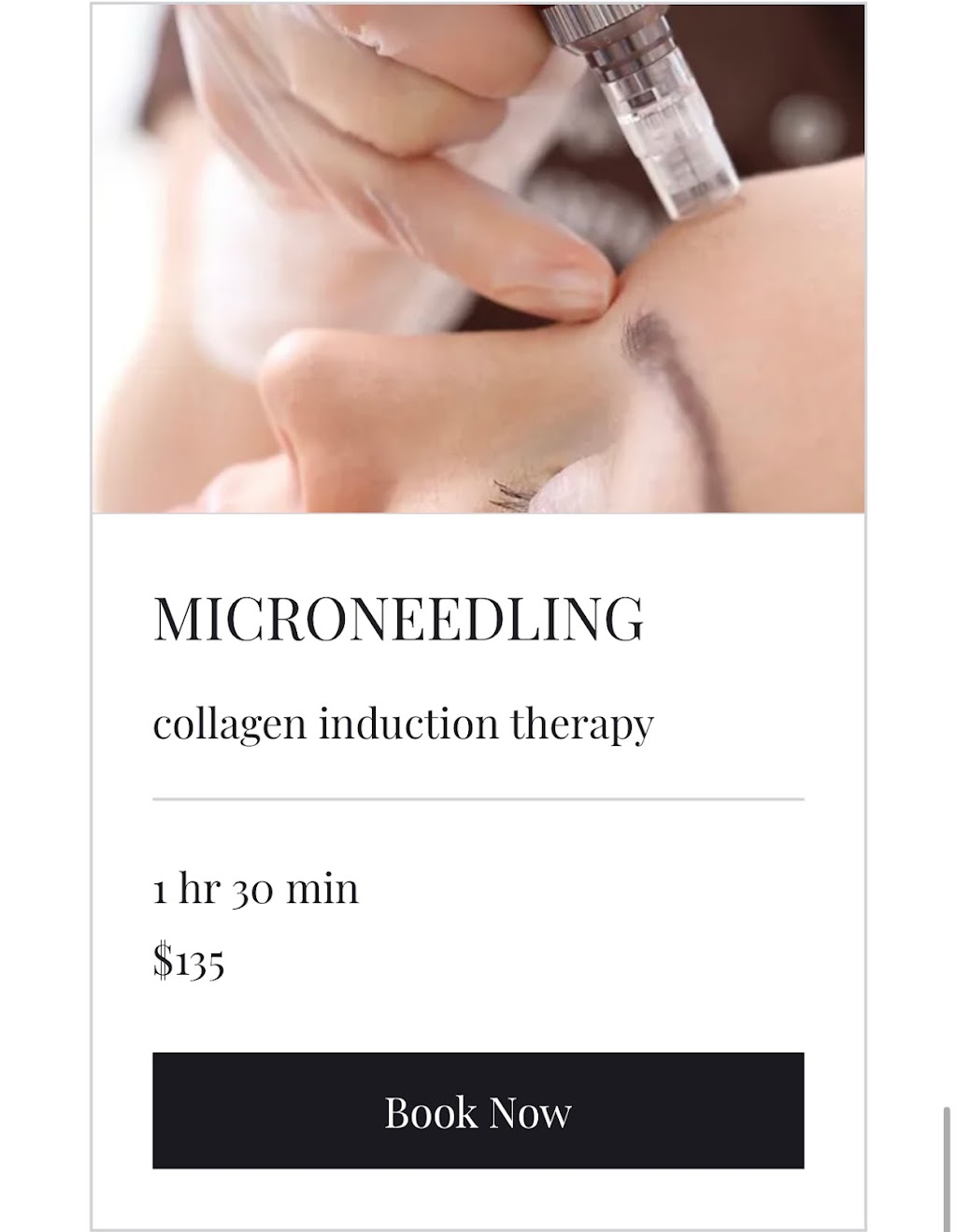 Lunar Aesthetics | Edmunds Crescent, London, ON N5Z 4J1, Canada | Phone: (519) 494-2684