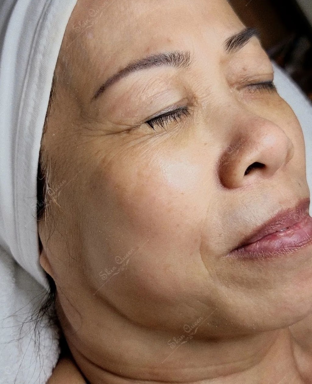 Skin Queen | 4356 Colonel Talbot Rd, London, ON N6P 1B2, Canada | Phone: (519) 204-8088
