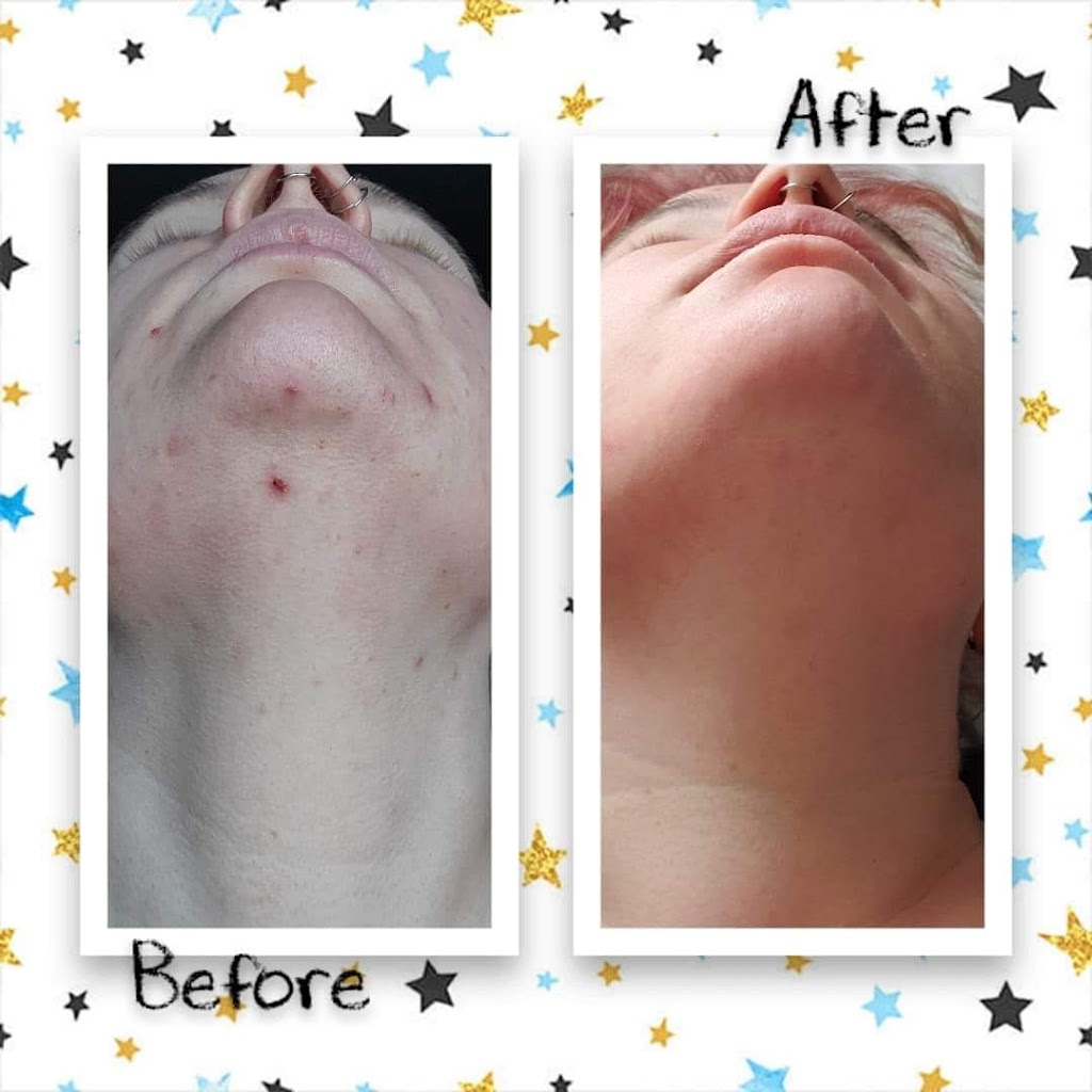 Vitality Esthetics & Medspa | 100 Kent St #140, Red Deer, AB T4P 4E5, Canada | Phone: (587) 815-5099