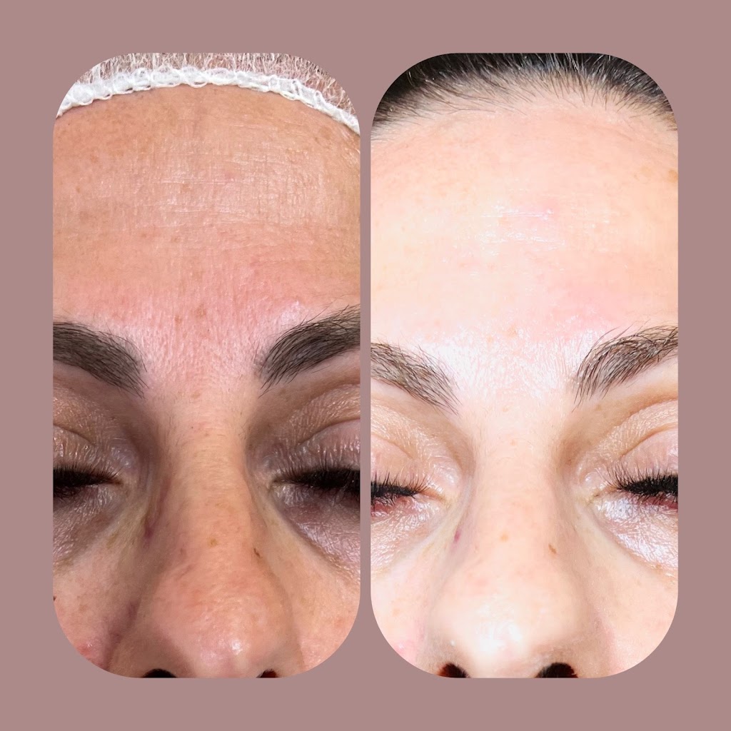 Blushes Forever Skin Care | H11C, 260300 Writing Creek Cres, Balzac, AB T4A 0X8, Canada | Phone: (825) 365-1610