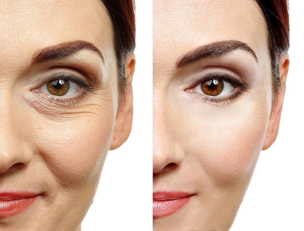 Blushes Forever Skin Care | H11C, 260300 Writing Creek Cres, Balzac, AB T4A 0X8, Canada | Phone: (825) 365-1610