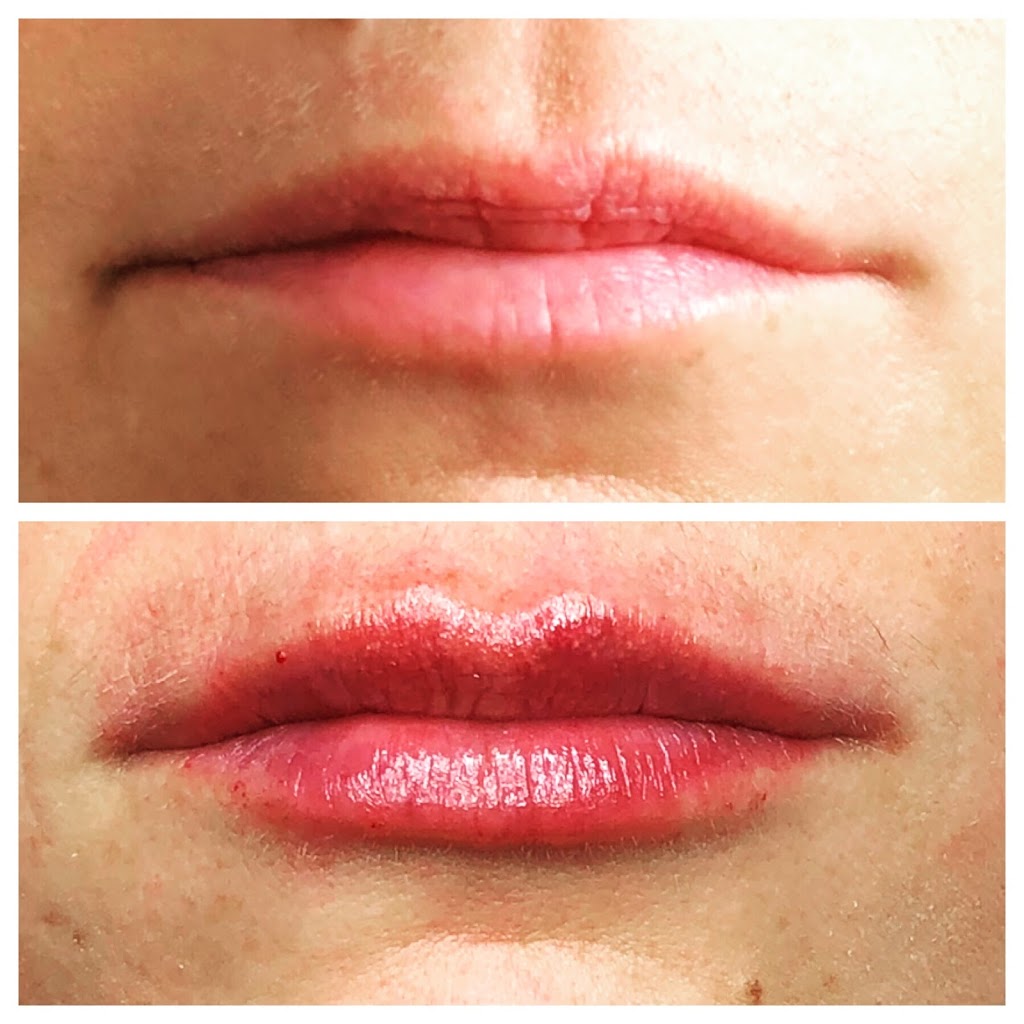 Allure Medical Aesthetics | 79 Rymal Rd W, Hamilton, ON L9B 1B5, Canada | Phone: (289) 389-8800