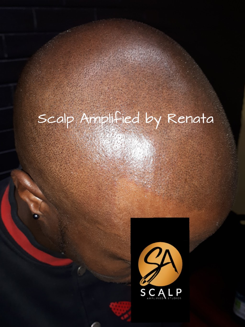Scalp Amplified Studios / Beauty Amplified Studio | 71 Speers Rd Unit #11, Oakville, ON L6K 0H9, Canada | Phone: (905) 929-9250