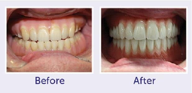 The Denture Center | 750-2601 Lauzon Pkwy, Windsor, ON N8T 3M4, Canada | Phone: (519) 969-6316