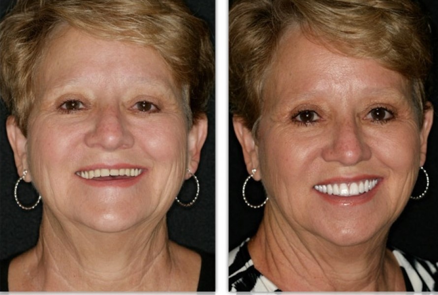 Dr.Hilma Rodriguez Family & Cosmetic Dentistry | 1275 Kensington Plaza Unit 7, Brockville, ON K6V 6C3, Canada | Phone: (613) 342-7070