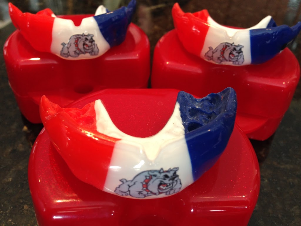 Xtreme Mouthguards | 51 Hidden Creek Point NW, Calgary, AB T3A 6J7, Canada | Phone: (403) 561-6881