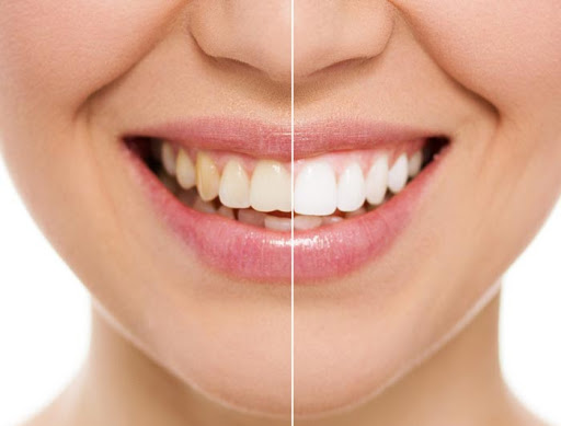 Dewdney Dental Center | 22214 Dewdney Trunk Rd, Maple Ridge, BC V2X 0E6, Canada | Phone: (604) 463-4838